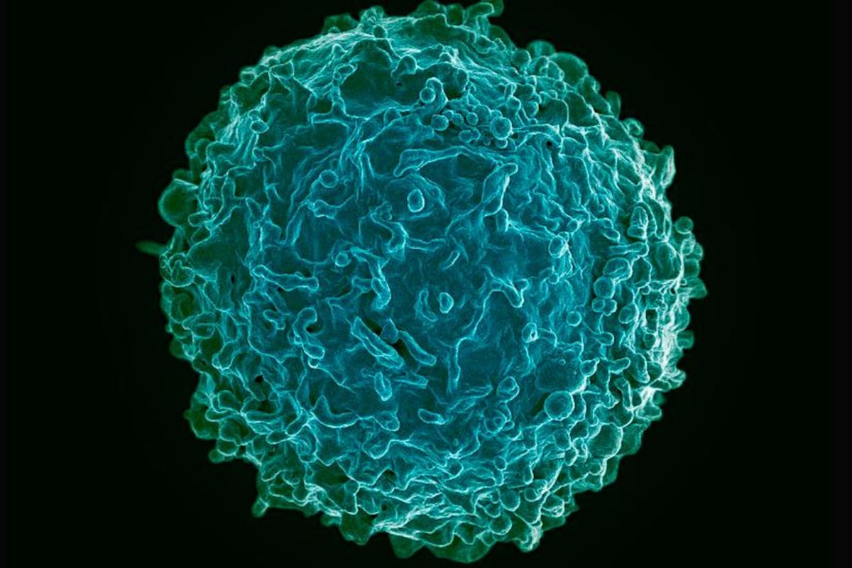 Experimento: una estrategia para prevenir la leucemia infantil