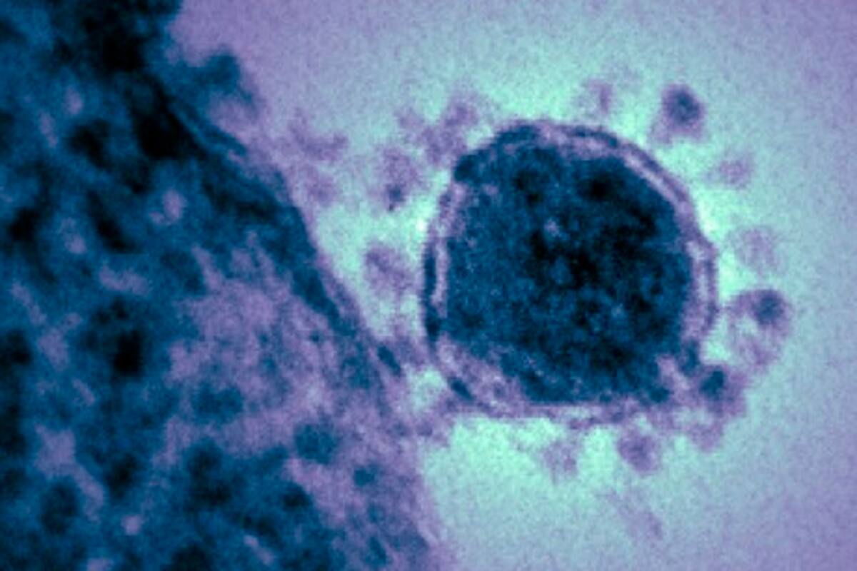 Científicos rusos logran descifrar la totalidad del genoma del coronavirus