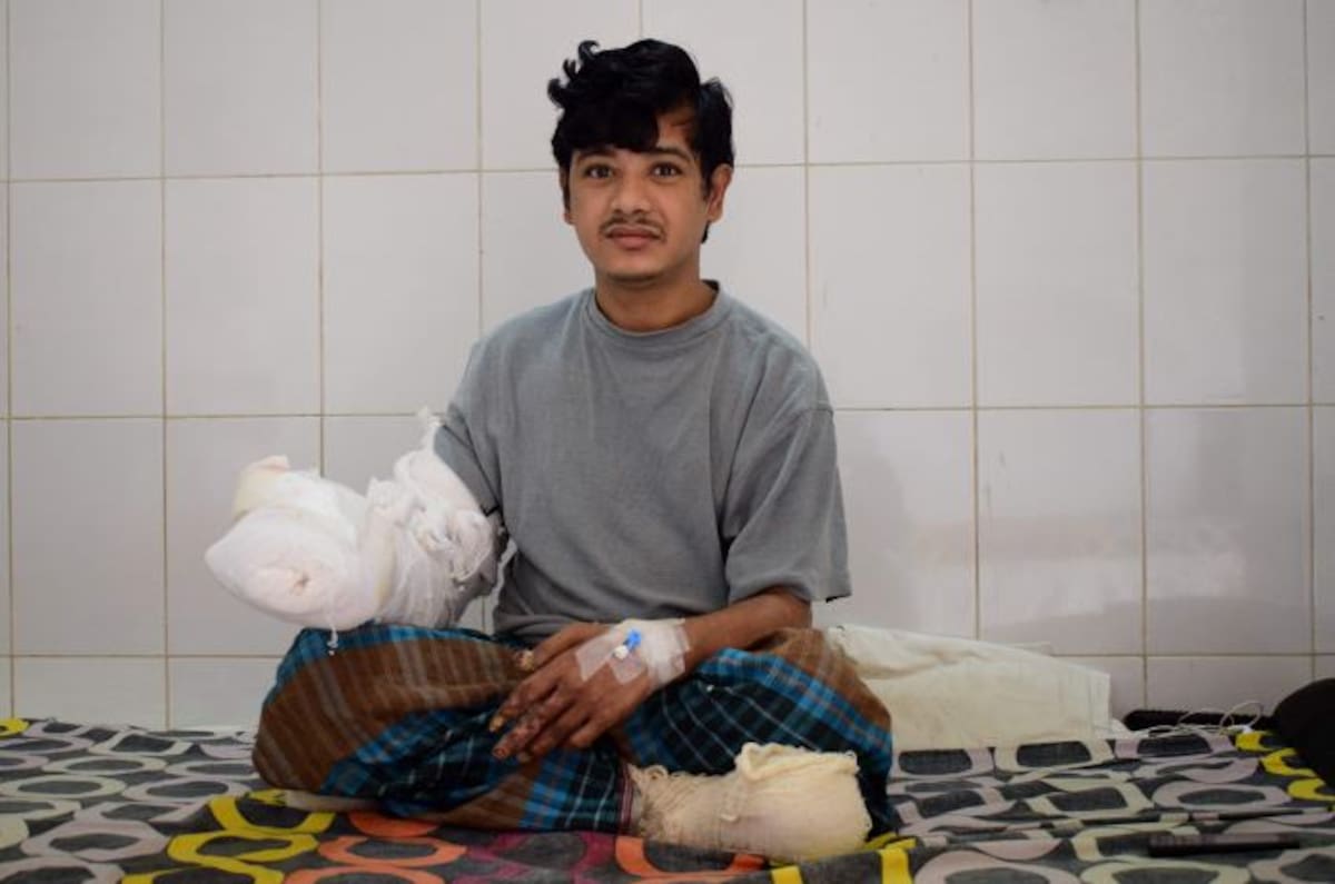 Abul Bajandar, de 27 años, perdió cinco kilos de gigantes excrecencias. AFP SAM JAHAN