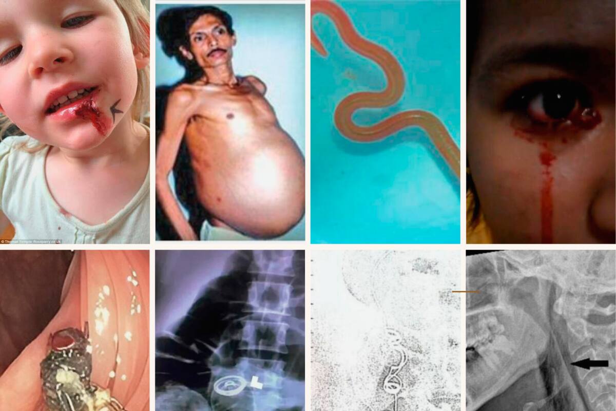 ¡Rarísimas! Estas son las 10 noticias de salud más insólitas de 2023