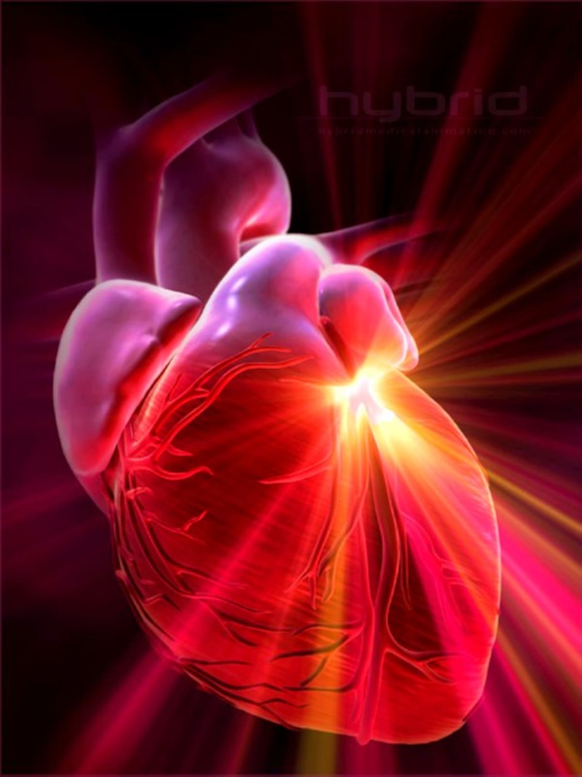 Las enfermedades cardio cerebrovasculares son la primera causa de morbilidad y mortalidad en Colombia.