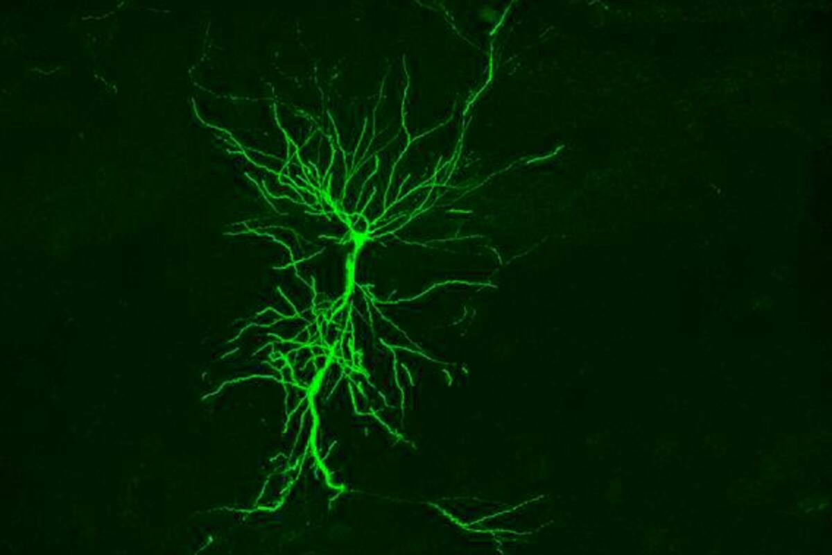 Crean una sonda que usa la luz para diagnosticar patologías cerebrales