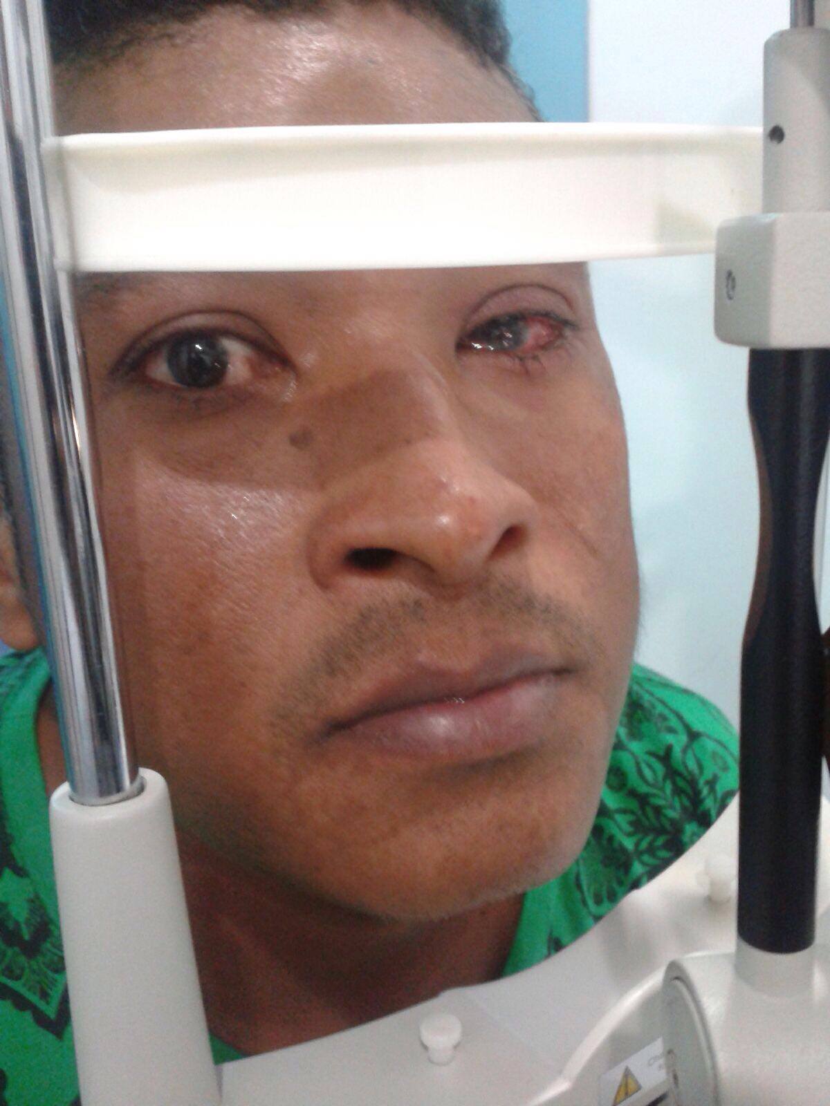 Edgar Paredes señala que fue herido con balas de goma por las autoridades. Cortesía Carlos Figueroa