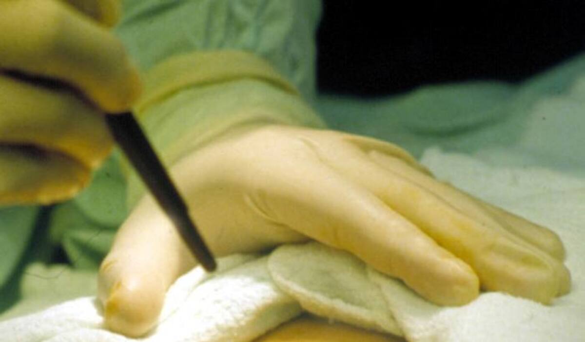 Los médicos coordinadores de trasplantes son personas entrenadas para trabajar con el donante. COLPRENSA