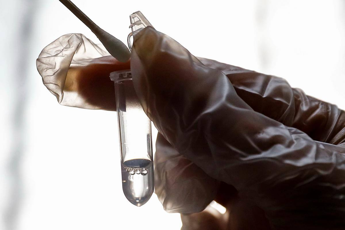 ¿Qué tiene que ver el ajo con el coronavirus? La OMS aclara 15 mitos