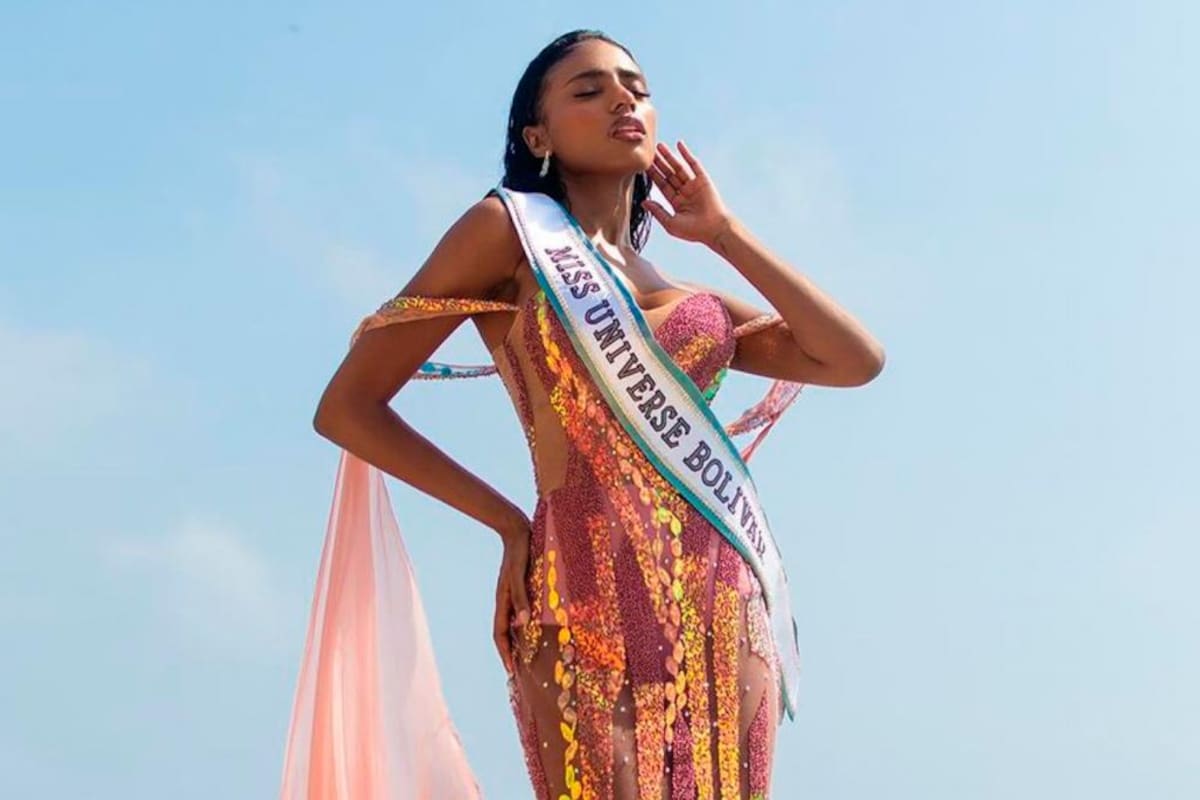 La cirugía que se hizo Kelly Reales para el Miss Universe Colombia