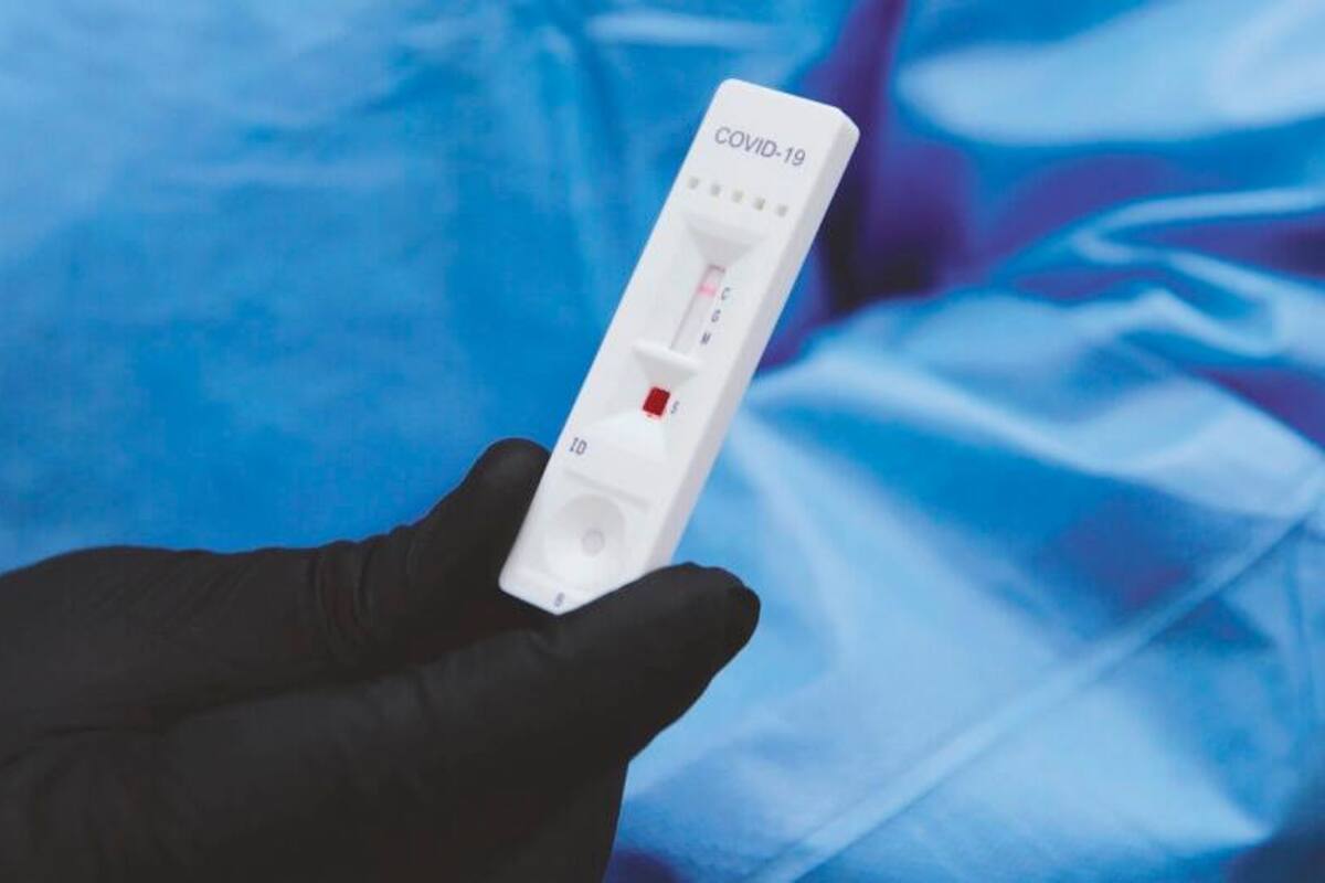 Alcaldía finaliza cuestionado contrato de 10 mil pruebas rápidas