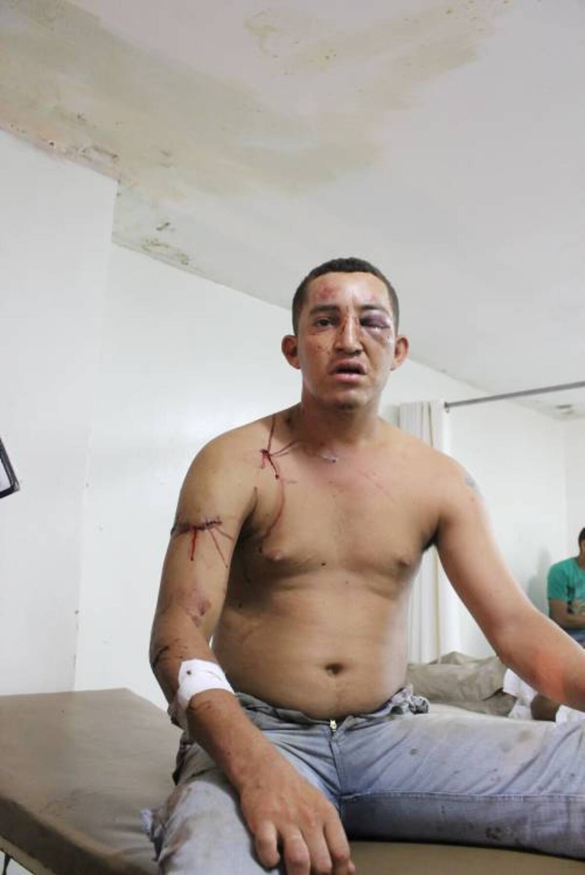 Nayib Acosta Sierra, herido por su madre. CORTESÍA