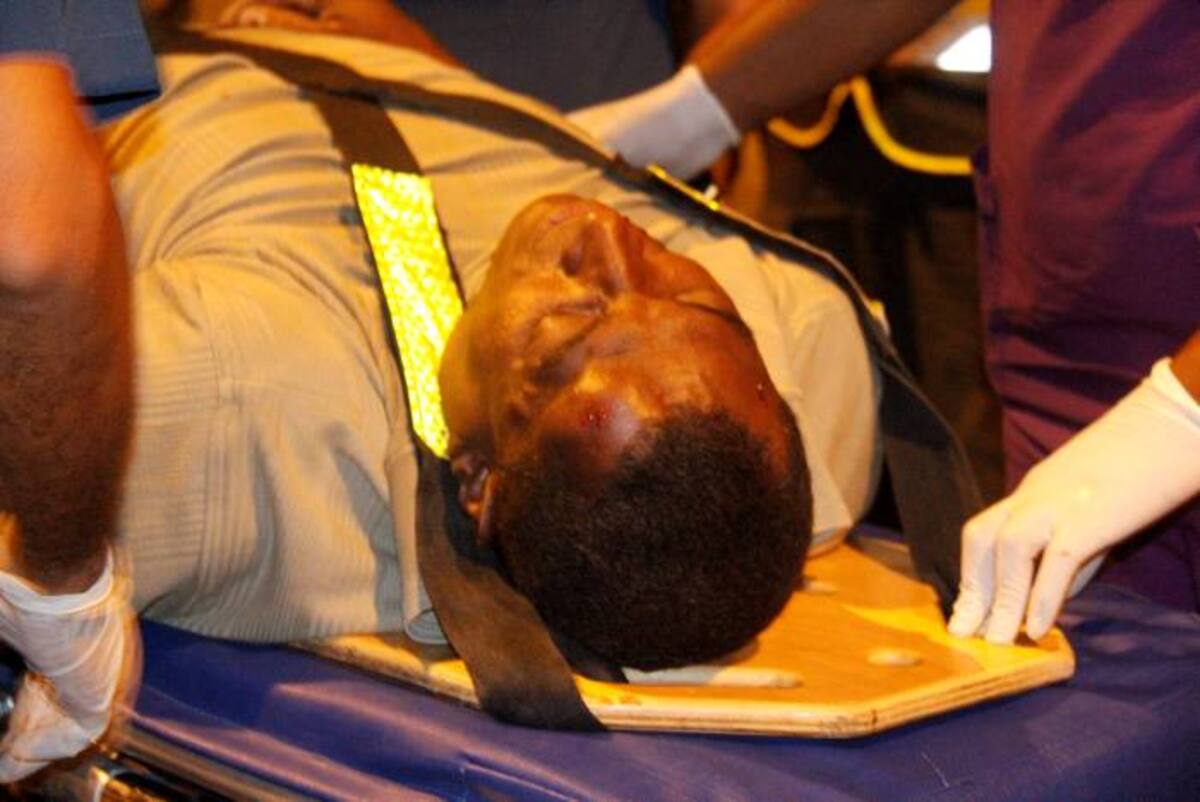 EL conductor de la moto resultó herido y tuvo que ser trasladado por una ambulancia para ser atendido en un centro médico. NAYIB GAVIRIA- EL UNIVERSAL