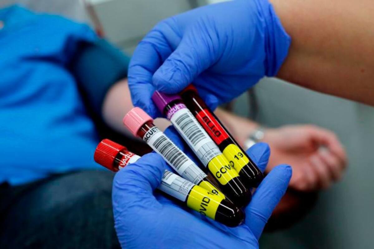 Córdoba reporta el más alto nivel de contagios de COVID-19 en un día