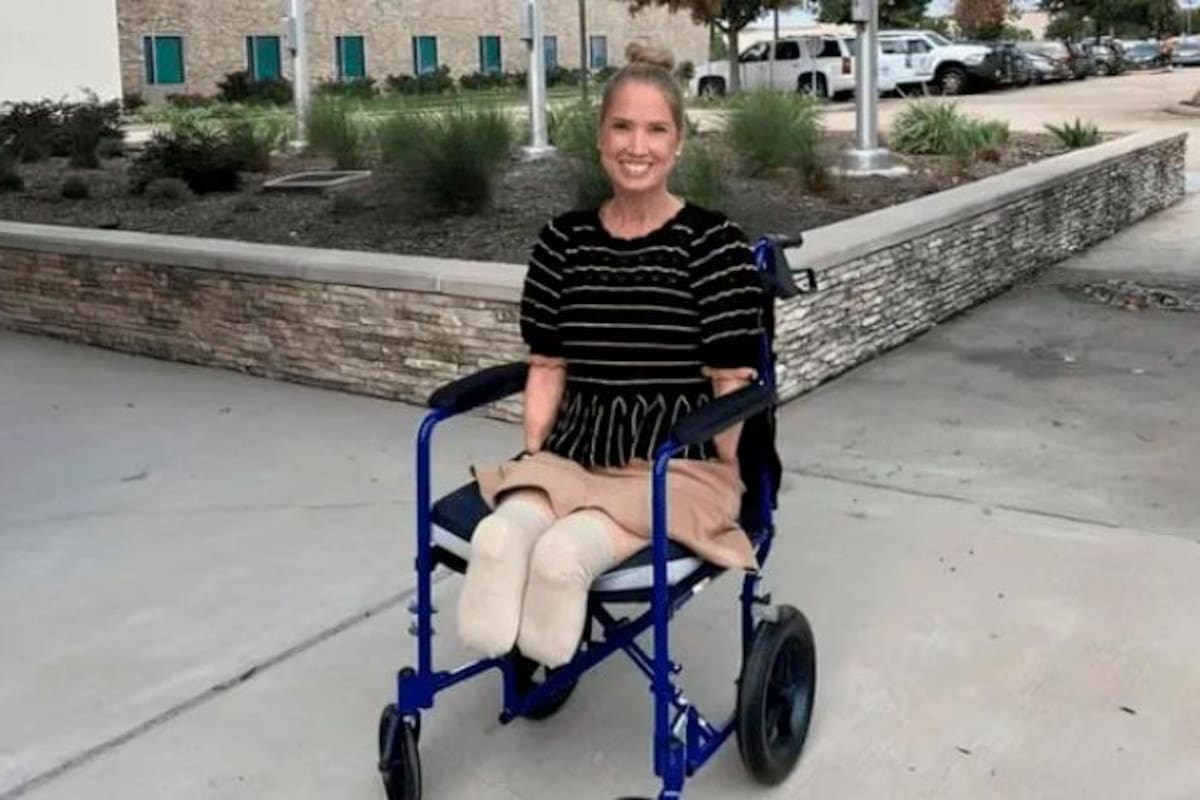 Le amputaron pies y manos tras un dolor de garganta: esta fue la razón