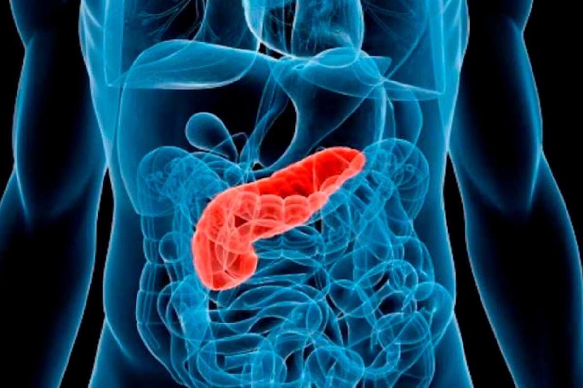 IA china ayuda a detectar el cáncer de páncreas en una fase temprana