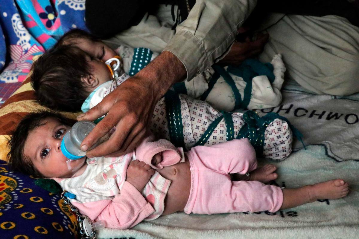 ¿Le das leche de fórmula a tu hijo?, deberías analizarlo, según la OMS