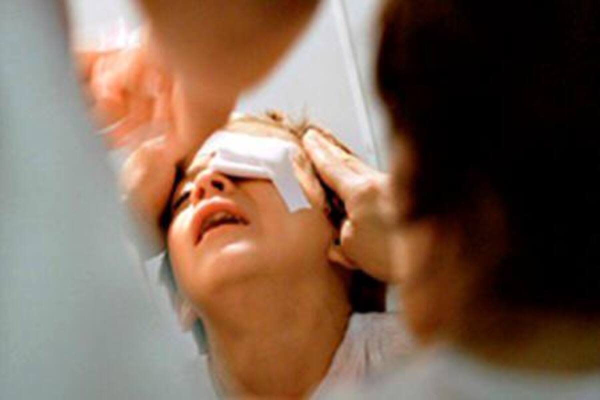 Los sí y los no en caso de una quemadura, cualquiera sea la causa