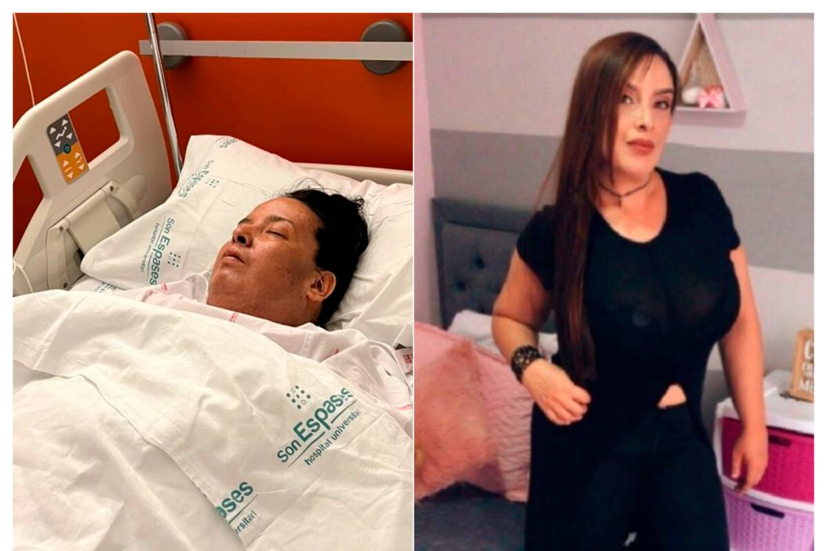 Colombiana con cáncer terminal en España pide ayuda para volver a casa