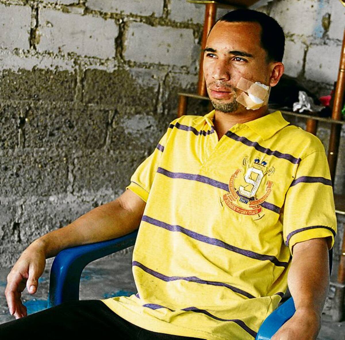 Fabián Ramírez espera que este lunes le entreguen los resultados de unos exámenes médicos, que determinarán si le extraen o no el proyectil.
