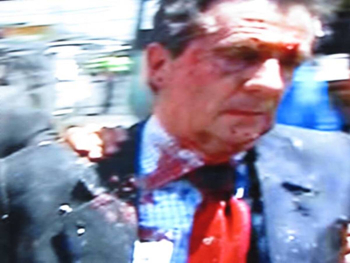 El exministro Fernando Londoño resultó con heridas leves en la cabeza y el tórax, por las cuales fue trasladado a una clínica del Country.