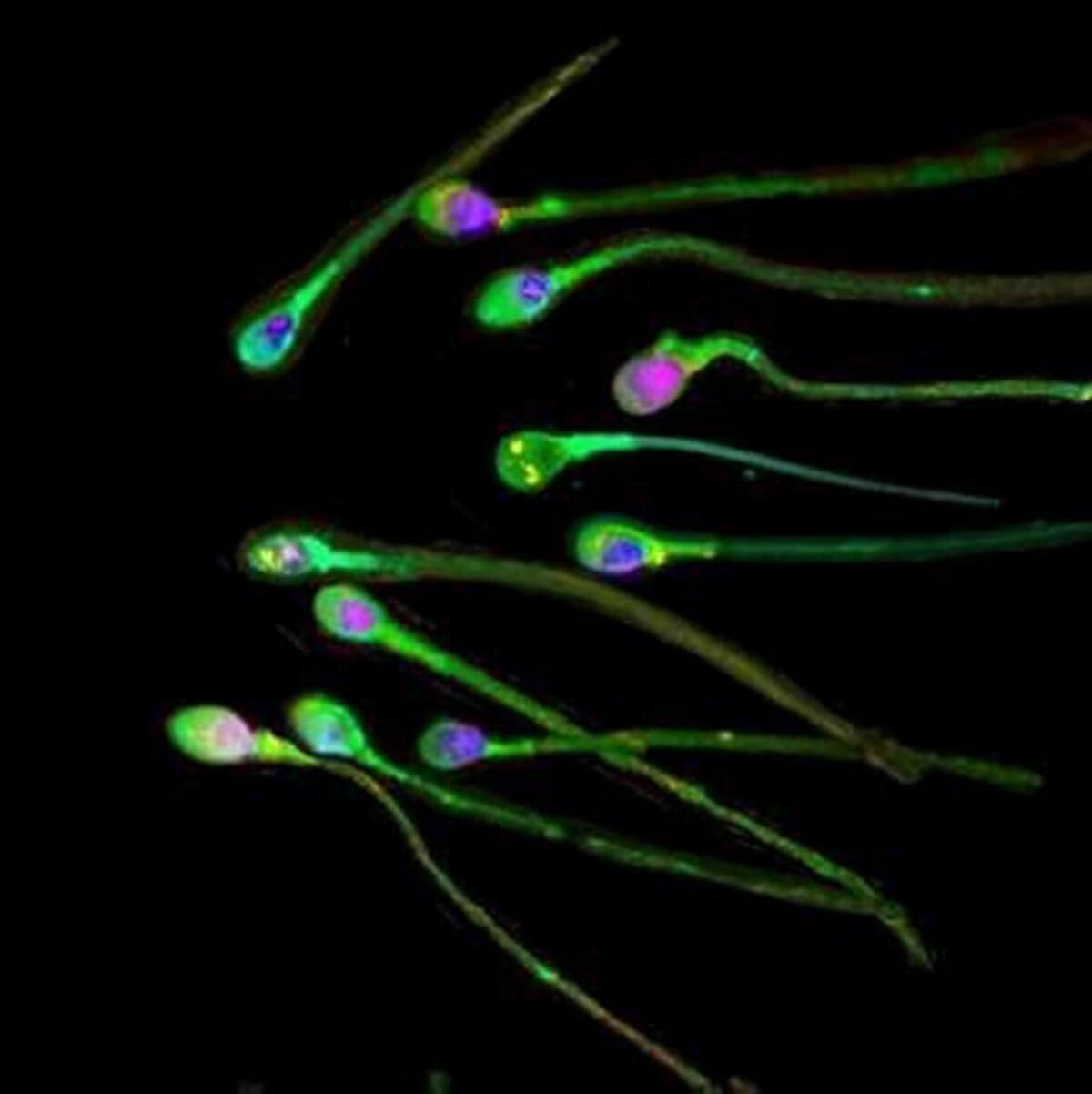 La nueva prueba puede analizar un video de una muestra de semen sin diluir y sin lavar en menos de cinco segundos. Archivo.