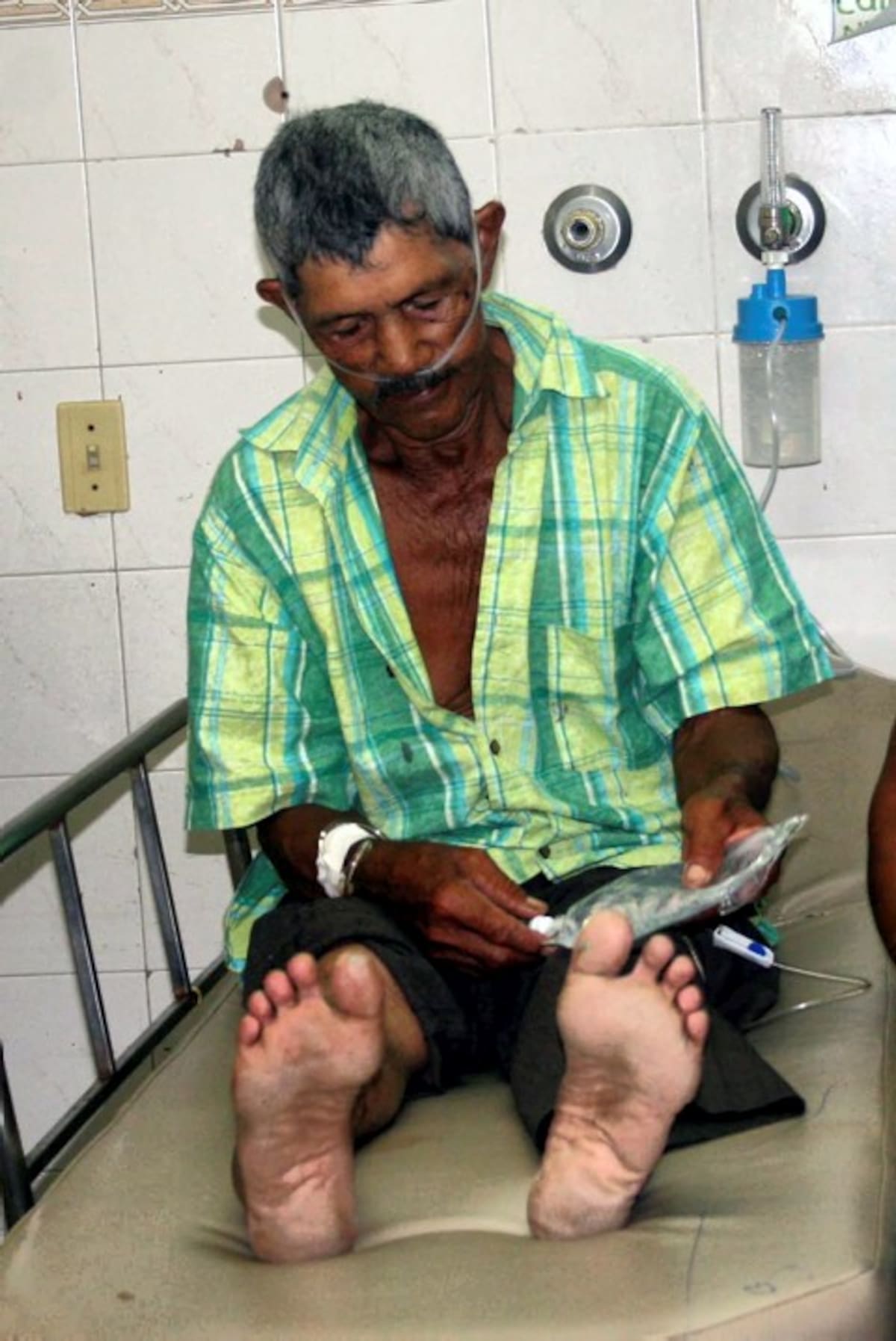 Elías Chávez Pérez, campesino mordido por una culebra mapaná blanca.