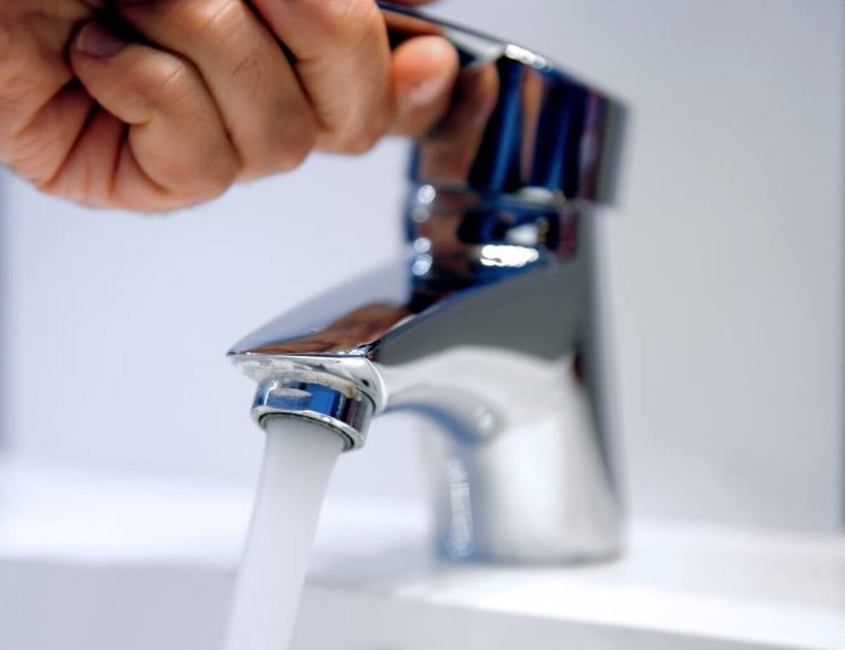 Es necesario lavar bien la herida con agua y jabón PHILIPPE HUGUEN - AFP