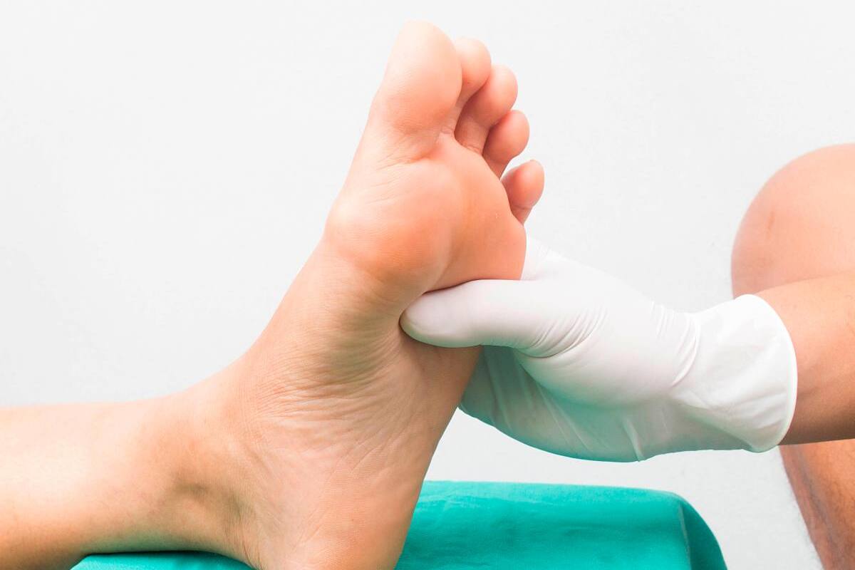 El 30% de los pacientes en Colombia tienen neuropatía diabética