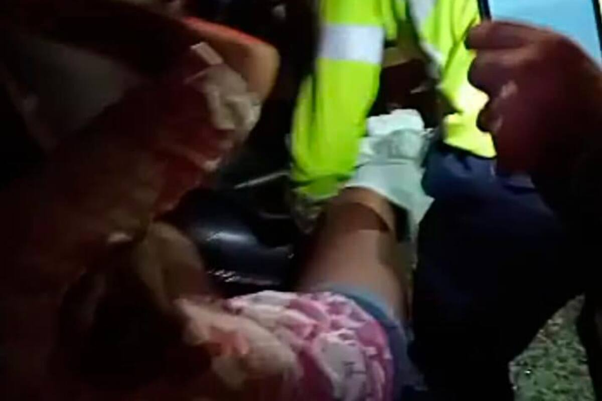 Video: Choque de motos en La María deja a mujer con pierna destrozada