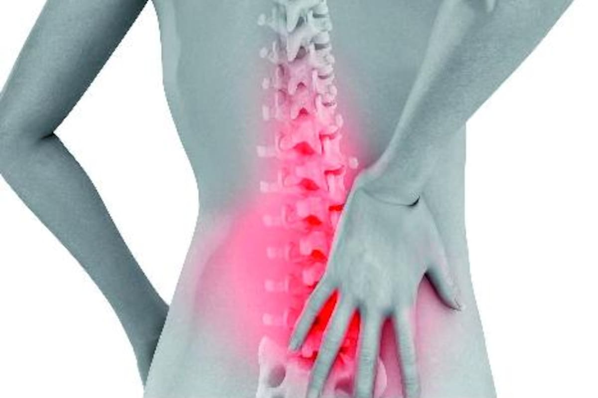 Todo lo que debe saber sobre la osteoporosis