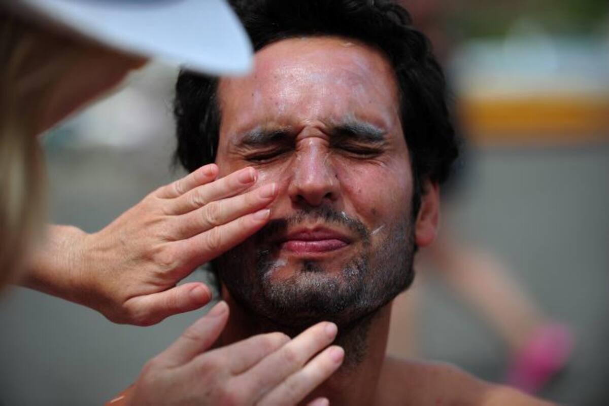 La rosácea uno, dos y tres afectan la piel y la cuatro afecta a los ojos, en el grado uno está el típico enrojecimiento que se torna persistente. AFP MARTIN BERNETTI