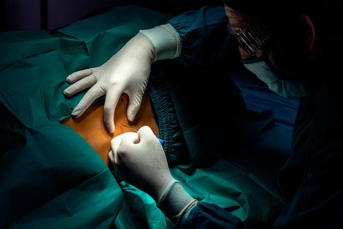 Turismo médico: 4 consejos para realizarse una cirugía plástica en Colombia