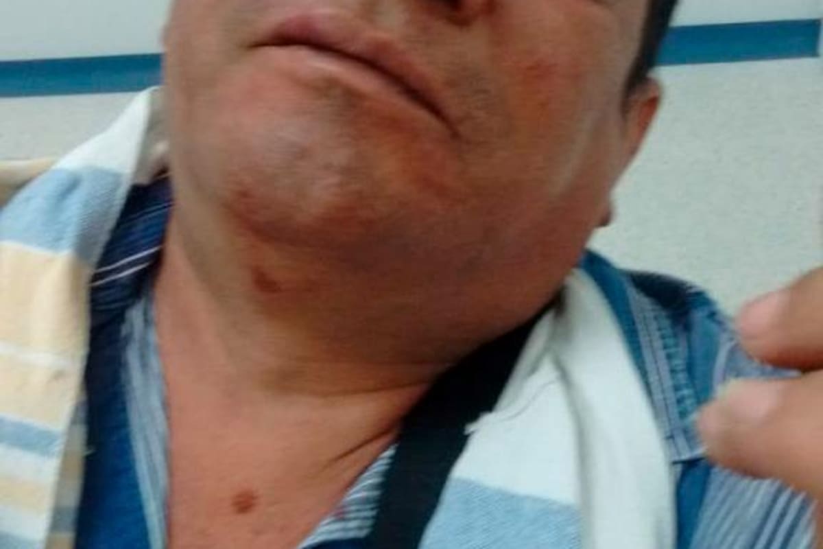 Jóvenes le propinan brutal golpiza a taxista en Montería