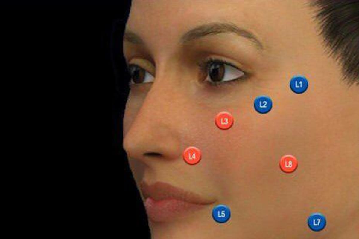 Los puntos clave del ácido hialurónico
