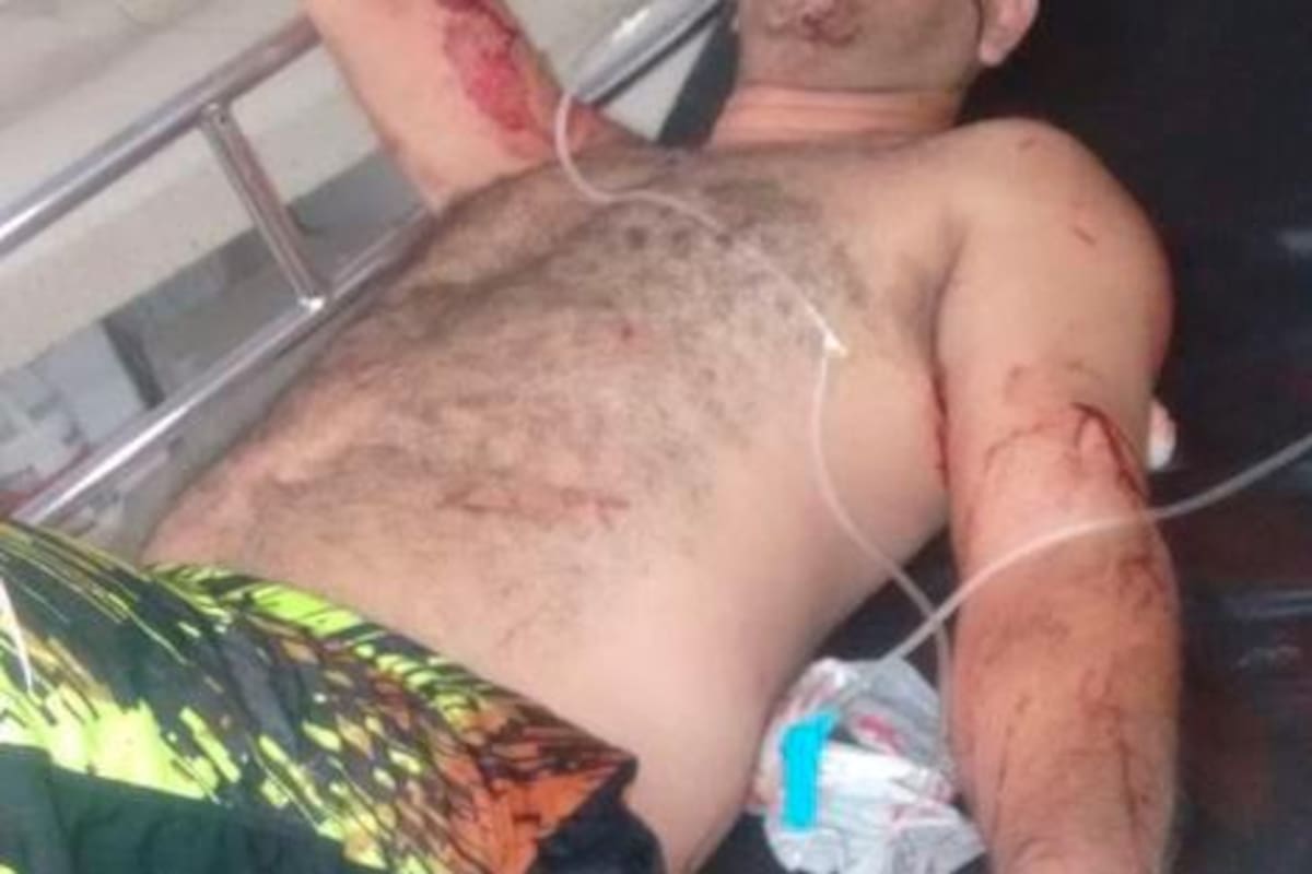 Taxista es herido de siete puñaladas por un atracador