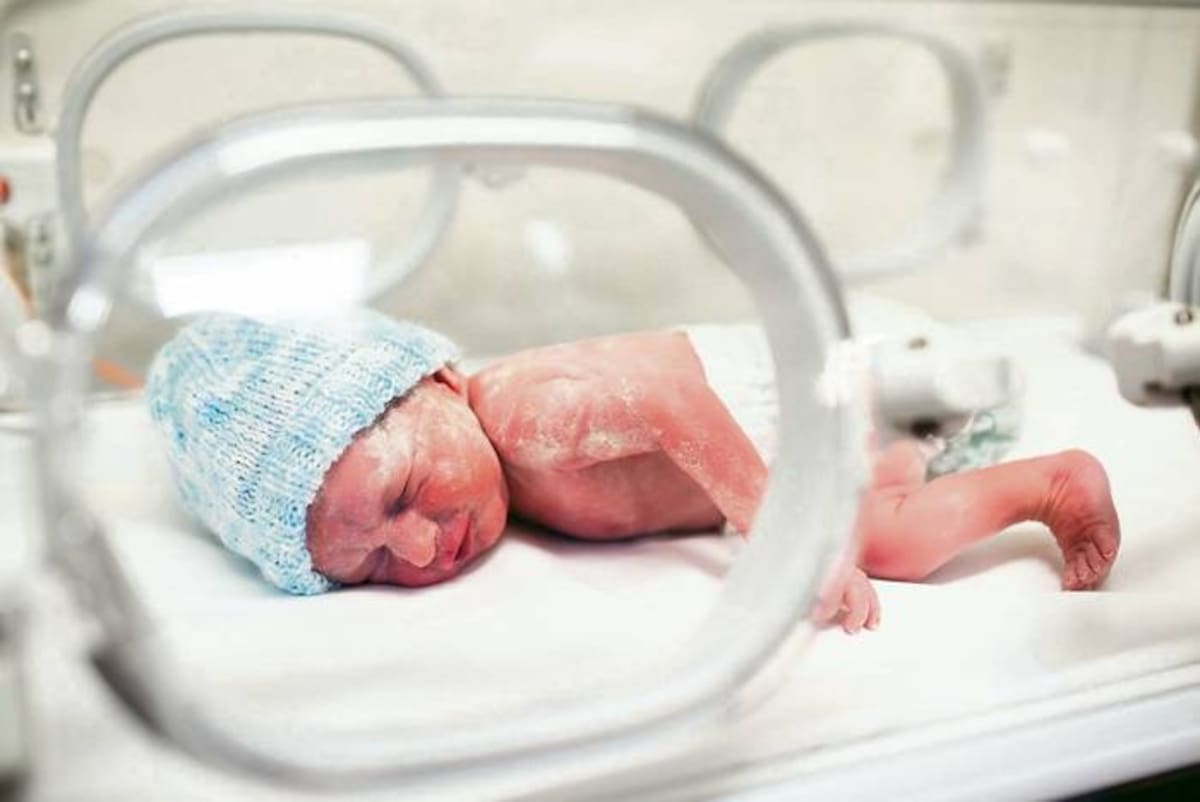 El bebé prematuro es espacial, por eso requiere de mayor atención desde su nacimiento y un seguimiento por lo menos el primer año de vida. FOTO ROYALTY FREE 123