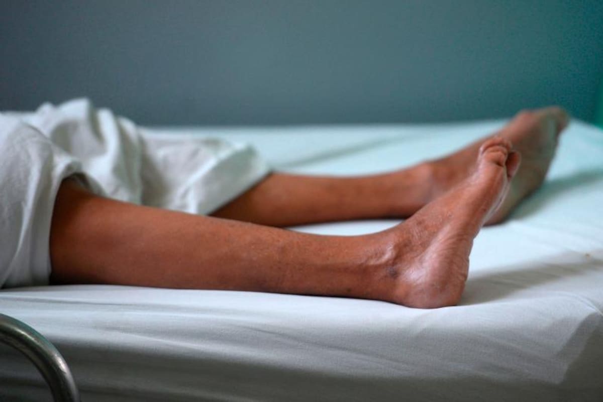 Alerta en México: 4 muertos por brote bacteriano asociado al Guillain Barré