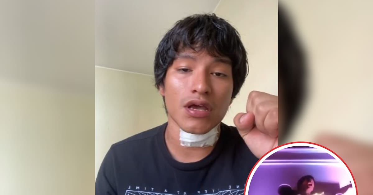 Cantante peruano sufre descarga eléctrica durante concierto en Lima