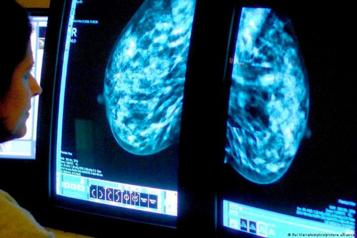 Cáncer de mama: mamografías a los 40 años salvan un 20 % más de vidas