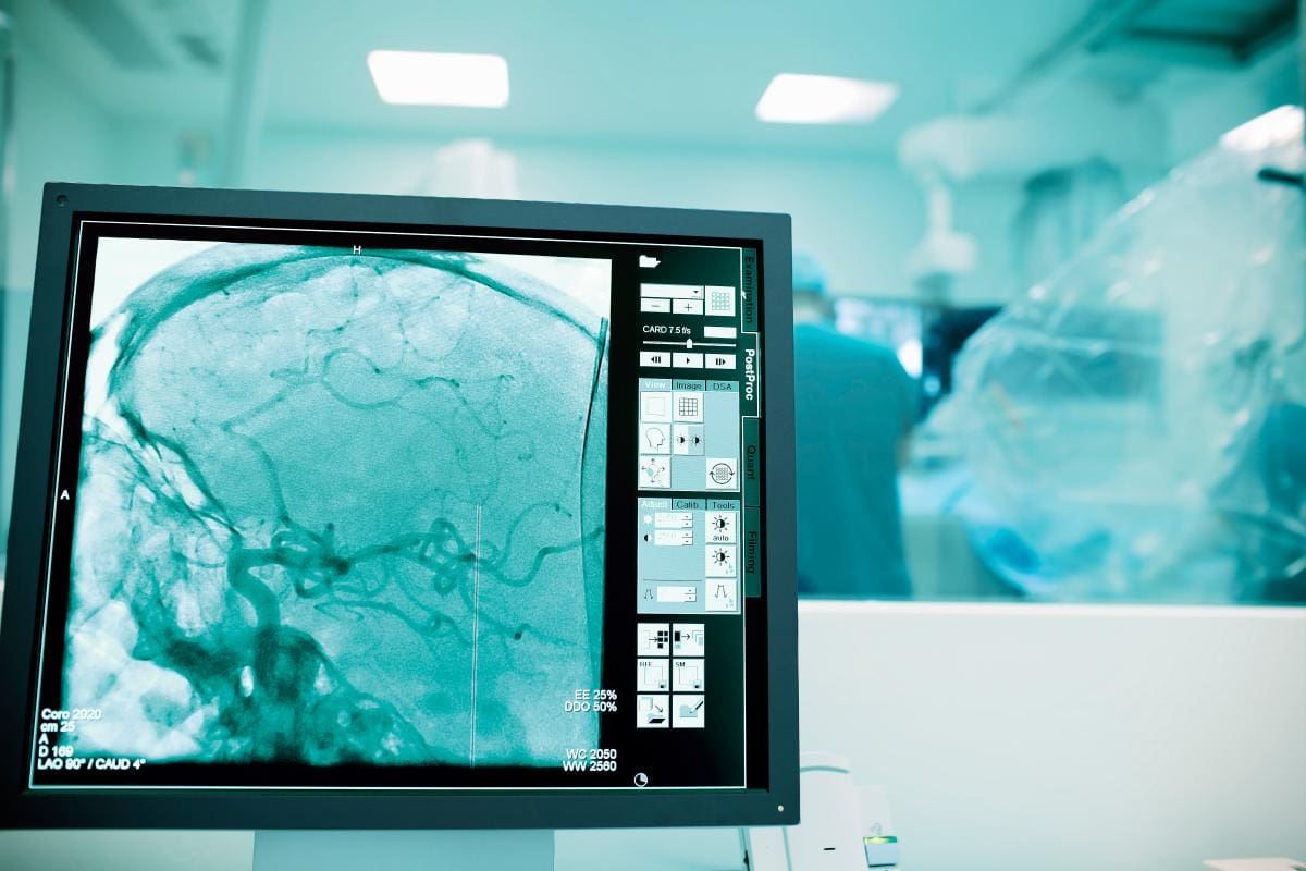 Maltrato y caídas, causas de traumas craneales en los niños