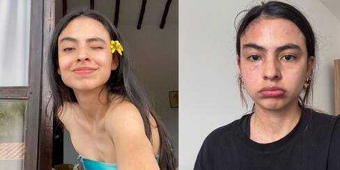 La dura enfermedad de Michell Orozco, actriz de ‘Lady, la vendedora de rosas’