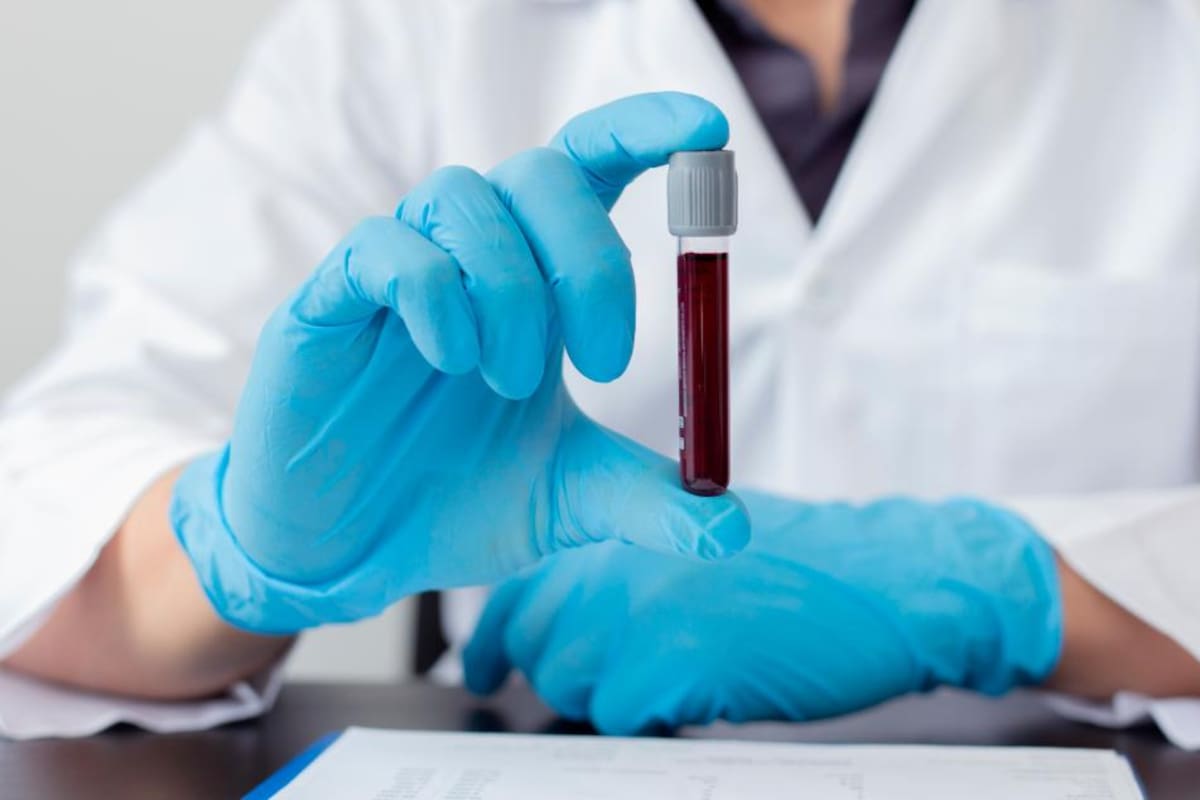 ¿Una simple muestra de sangre tiene el potencial de detectar cáncer?