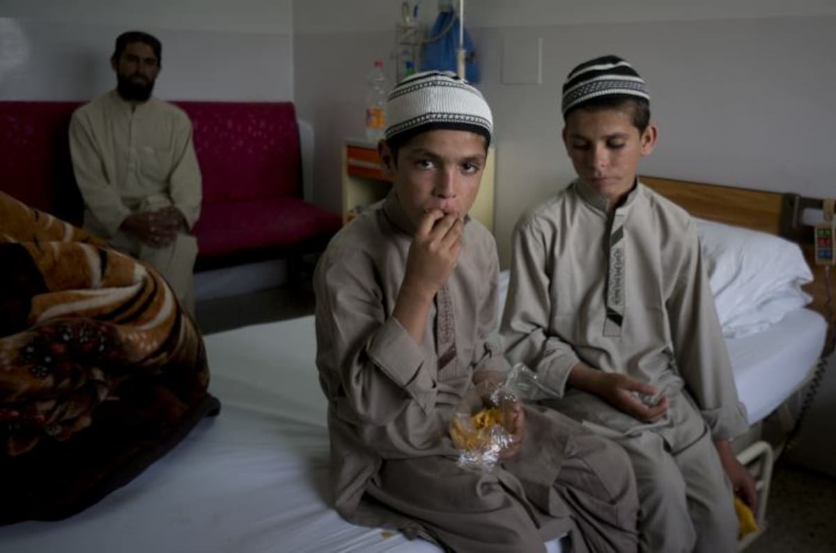 El caso de los llamados Niños Solares despierta el interés de los médicos en Pakistán. AP B.K. Bangash