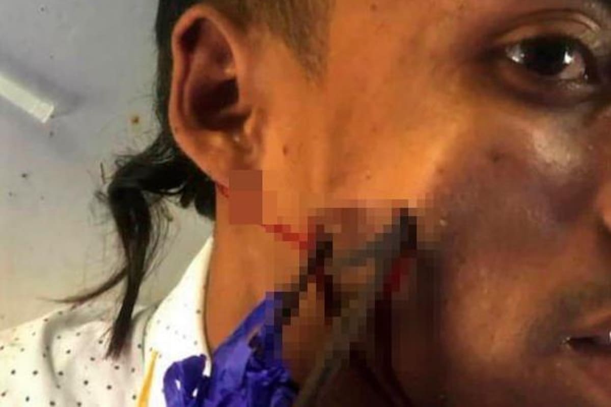 Video: ¿Karma? Banderillero se clavó su propia banderilla en la cara