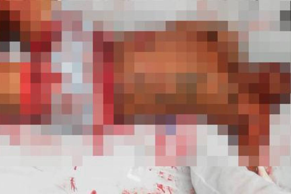 Graves están los 2 presuntos ladrones agredidos en Cartagena