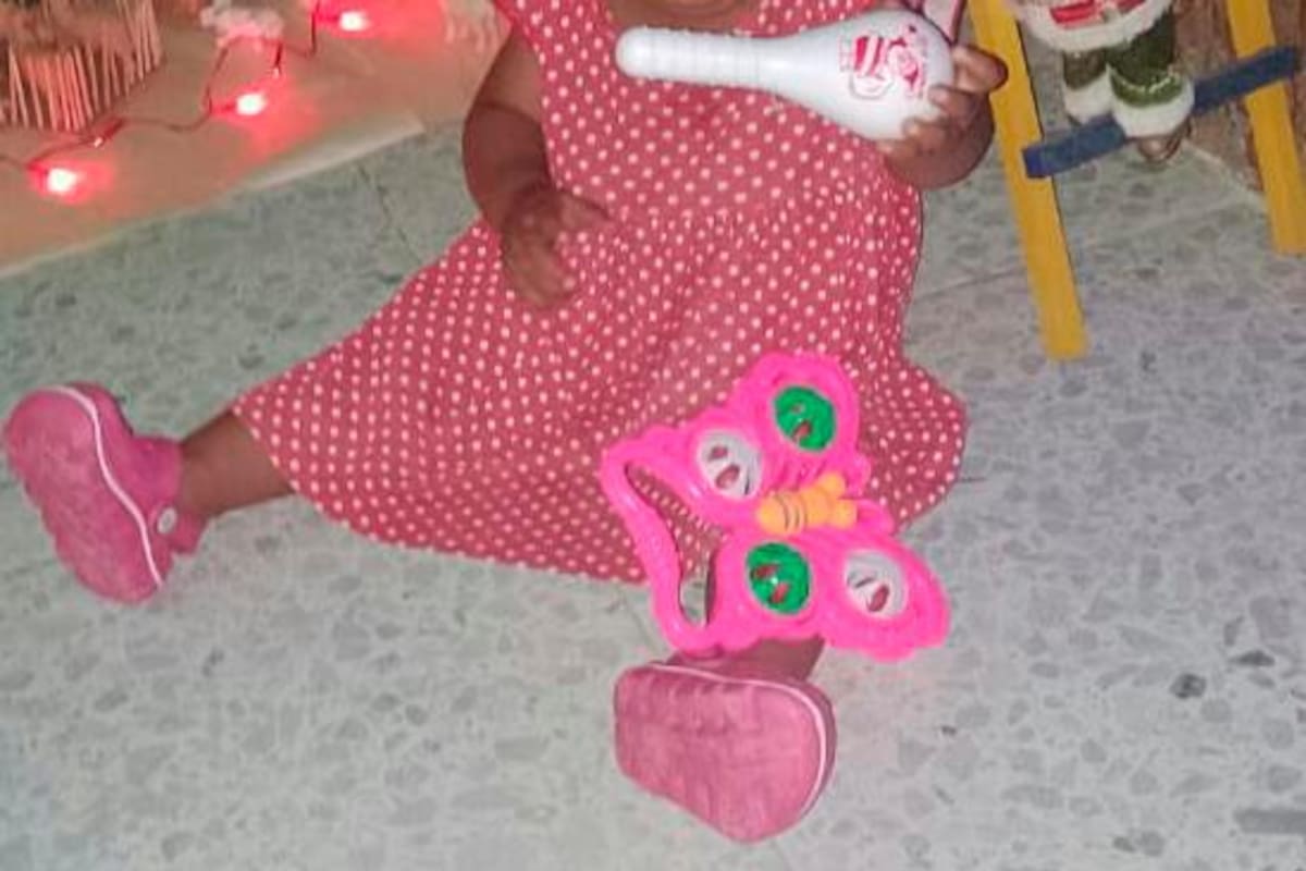 ¡Una ayuda para Milagros! Niña necesita cirugía de labio leporino