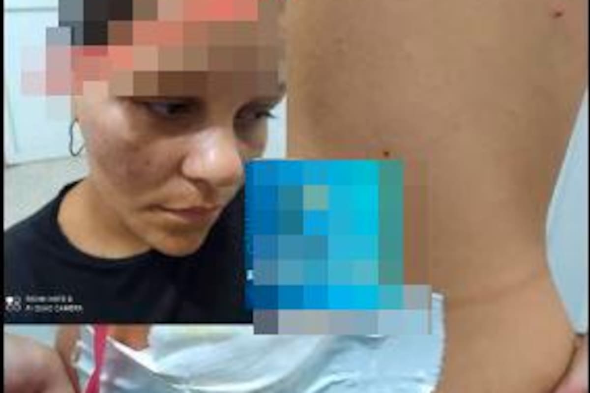 Con pico de botella agredieron a mesera porque no les puso una canción