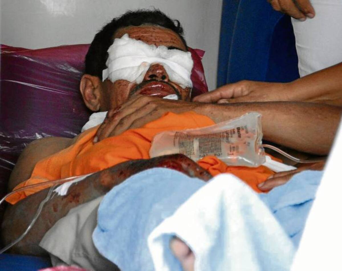 En la imagen, Wilmer Canchila Paternina, minero herido, cuando esperaba para ser sometido a una ecografía ocular.