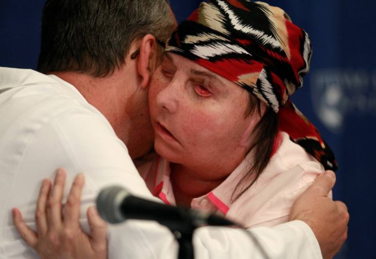 Médicos que realizaron el trasplante AP