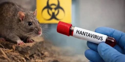 ¿Tiene hantavirus? Los síntomas que debe conocer tras el brote en el crucero