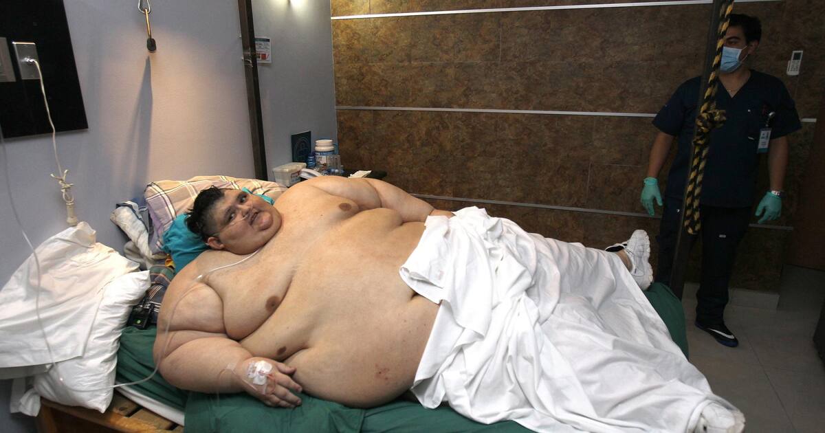 Fallece hombre reconocido por haber sido el más obeso del mundo: así lucía