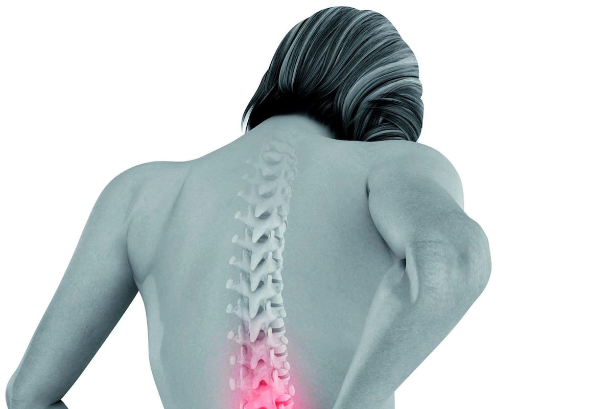 Pacientes con osteoporosis no tienen tratamientos ni diagnóstico adecuado