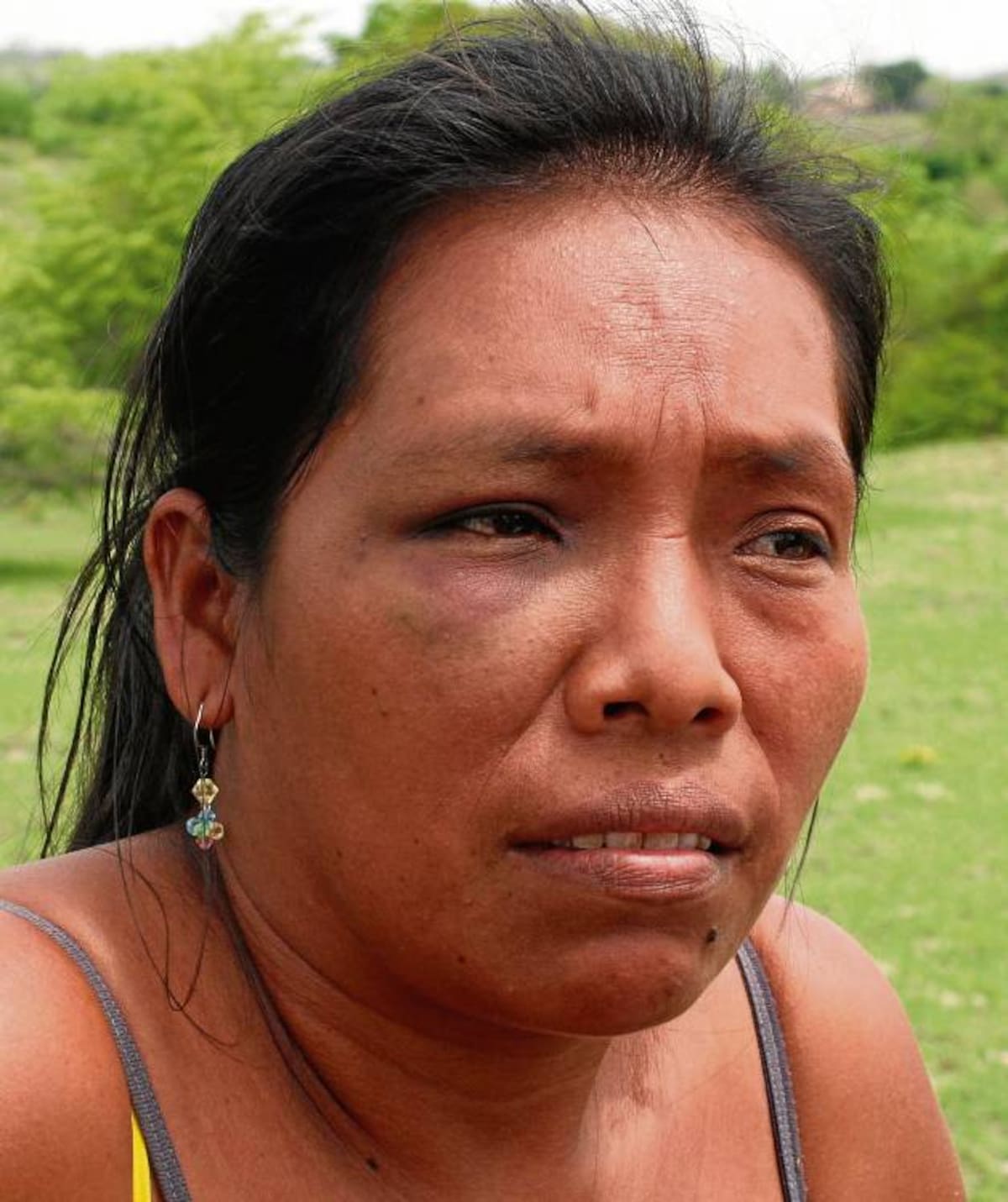 La mujer sufrió un hematoma en el arco superciliar derecho.